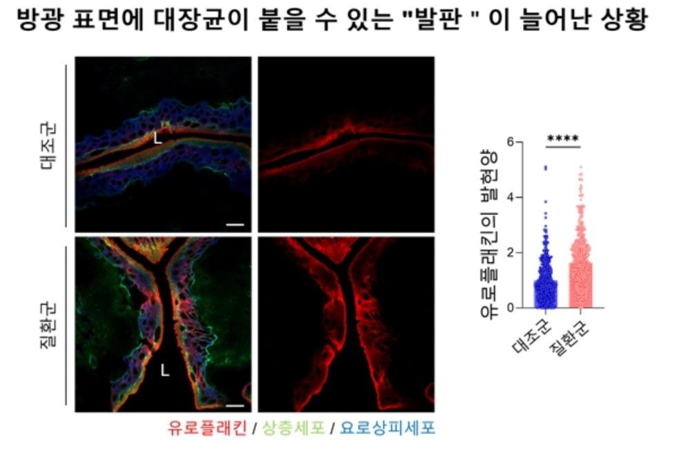 Gardnerella piotii가 분비하는 숙신산이 GPR91을 활성화해 유로플라킨 발현을 증가시키고 대장균의 방광 부착을 촉진하며, 이를 통해 '숙신산-GPR91-유로플라킨 축'이 재발성 방광염의 원인이 됨.